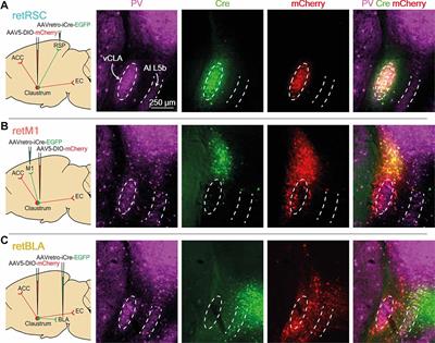 Topologically Organized Networks in the Claustrum Reflect Functional Modularization